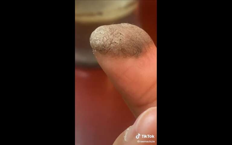 Vídeo de dedo com pelo pubiano chama atenção no TikTok