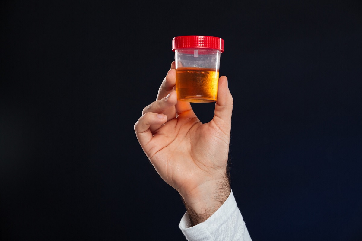 Teste caseiro de urina para detectar câncer de próstata