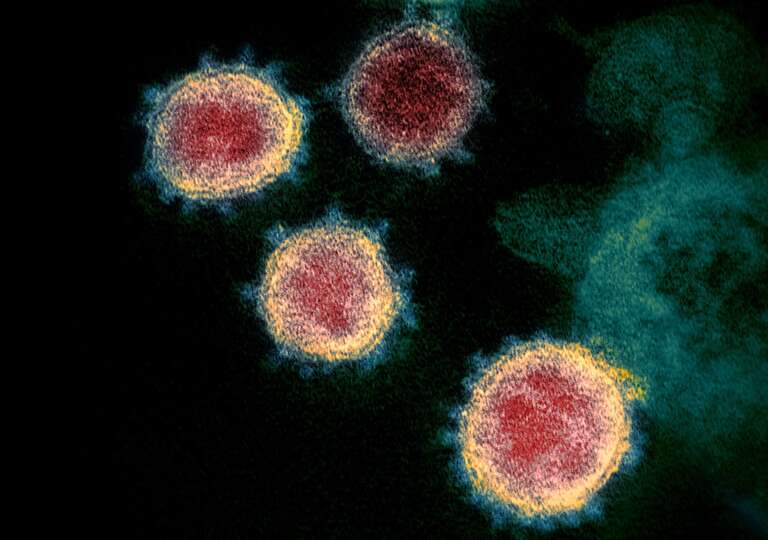 Covid longa pode ser causada pelo vírus da mononucleose, dizem cientistas