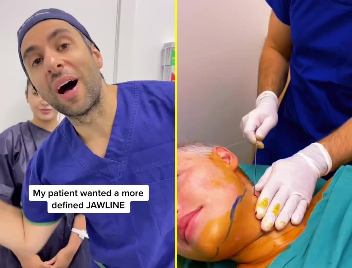 antes depois usando jaw line｜Pesquisa do TikTok