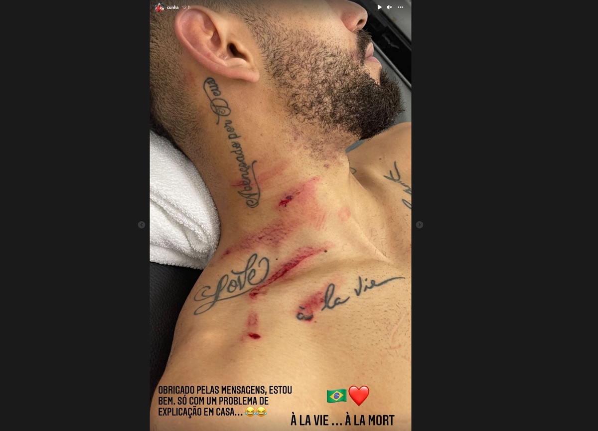 VÍDEO: Matheus Cunha exibe feridas da perigosa jogada na partida entre Brasil e Equador e cita &#34;ciúmes&#34; da esposa