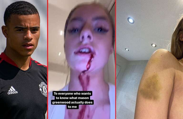 Jogador Mason Greenwood, do Manchester United, é acusado de agredir a namorada