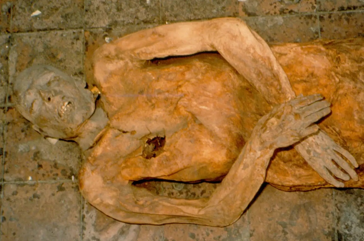 Estudo revela que múmia italiana do século XVI morreu por infecção causada por uma bactéria muito conhecida