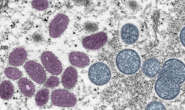 A varíola do macaco, que já afetou 48 pessoas no mundo, pode ser fatal?