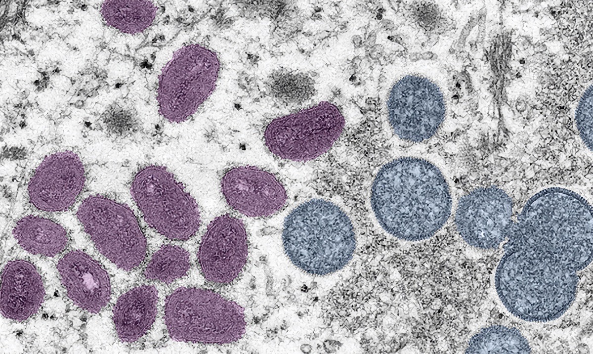 Mutações podem ter aumentado a capacidade de transmissão da varíola dos macacos