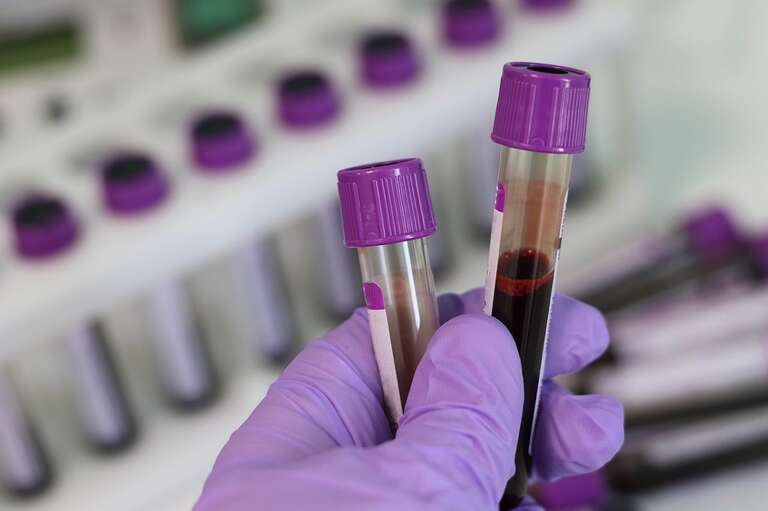 Cientistas criam terapia inovadora para pacientes com hemofilia B