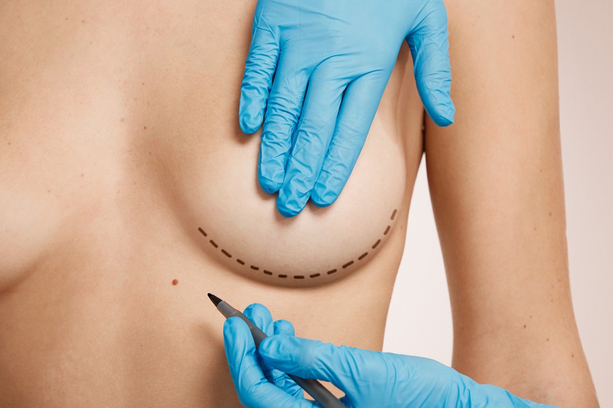 Novo implante mamário testado na Austrália é 100% natural e pode aposentar o silicone