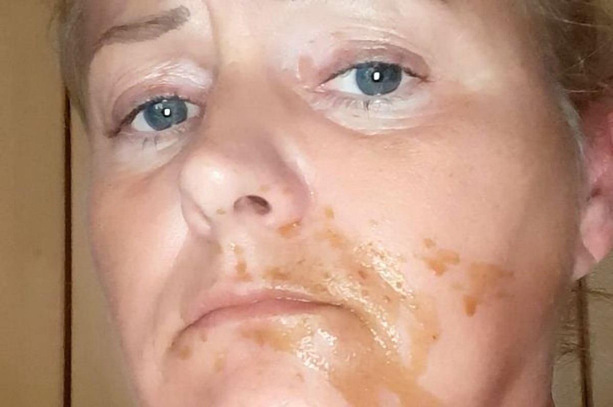Britânica fica três dias no hospital após o cachorro da família fazer cocô na cara dela