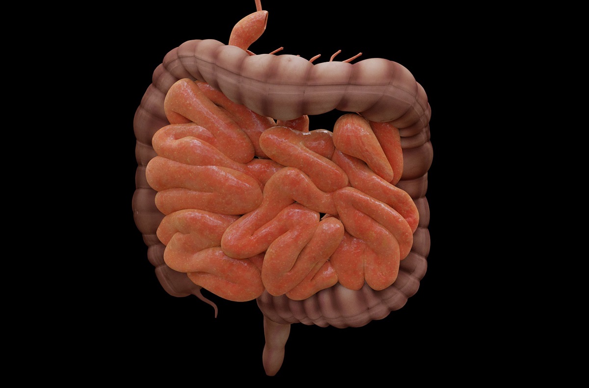 Inflamação no intestino pode ativar gene associado ao câncer colorretal, diz estudo