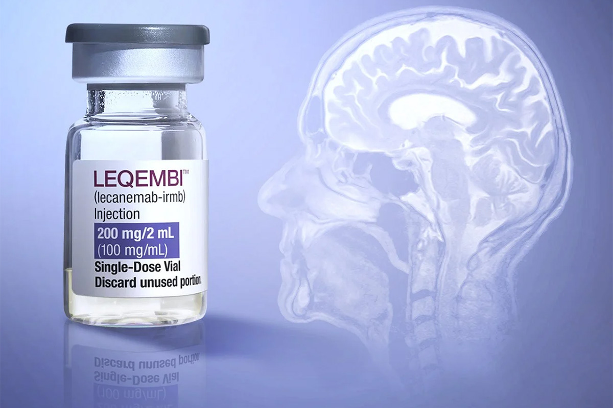 EUA aprovam uso de novo medicamento para retardar a progressão da Doença de Alzheimer