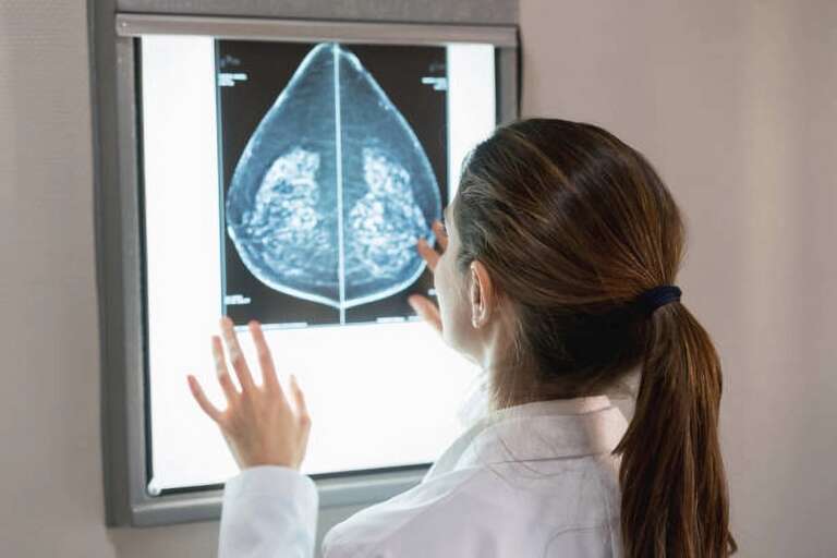 Inteligência artificial pode ser mais eficaz para detectar câncer de mama do que um médico, diz estudo