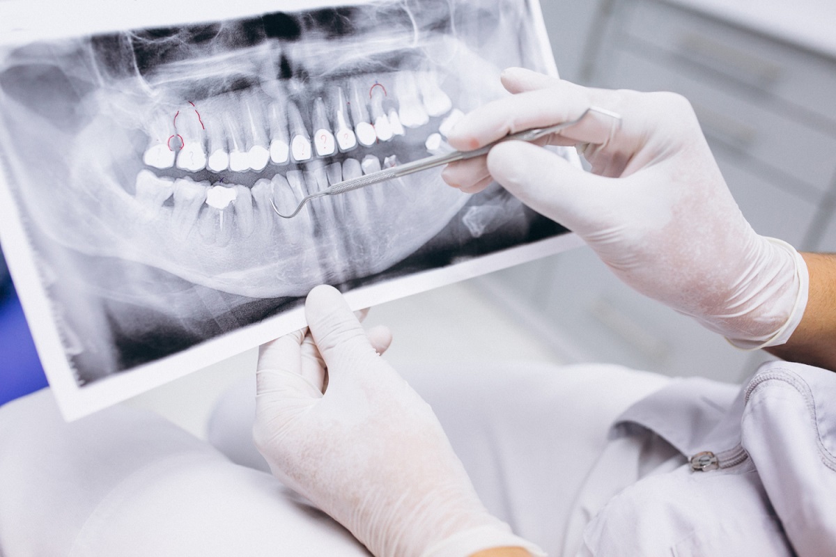 Fim da dentadura? Cientistas vão testar remédio que faz crescer dentes em adultos