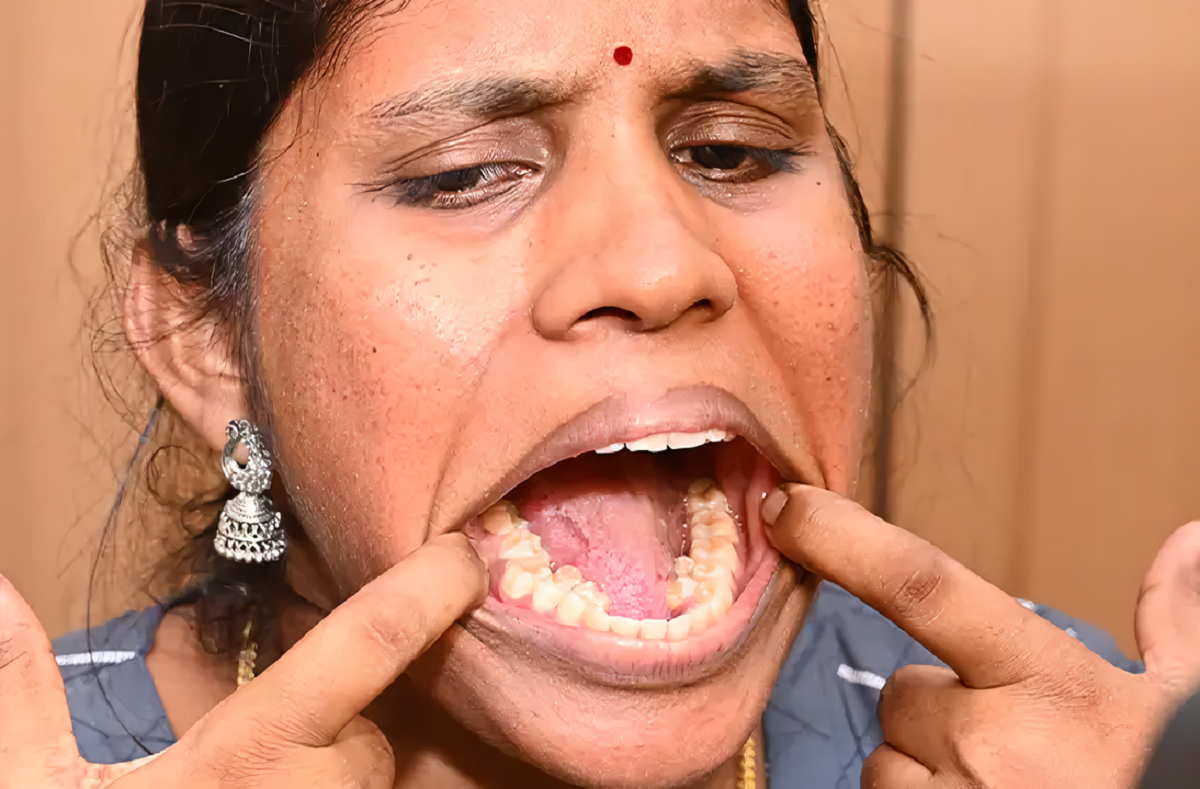 Com 38 dentes na boca, indiana entra para o livro dos recordes da Guinness