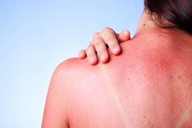 Após tomar sol por 2h, como "tratamento", chinesa sofre hemorragia cerebral e acaba em coma, no hospital